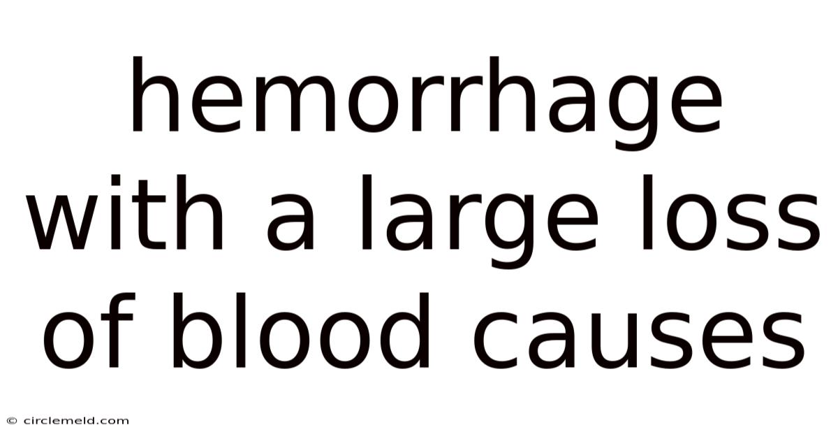 Hemorrhage With A Large Loss Of Blood Causes