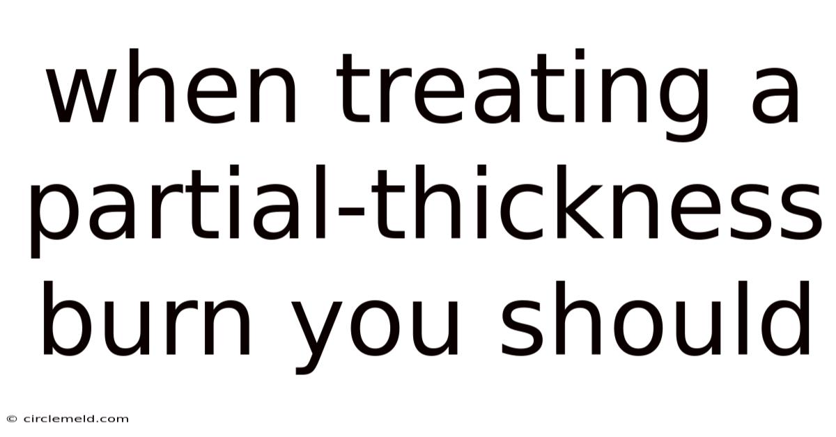 When Treating A Partial-thickness Burn You Should